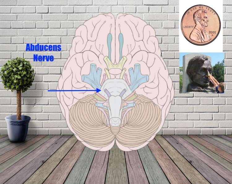 abducens nerve mnemonic example