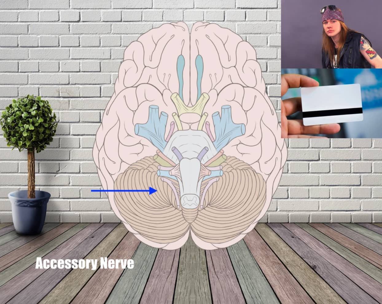 access nerve mnemonic example