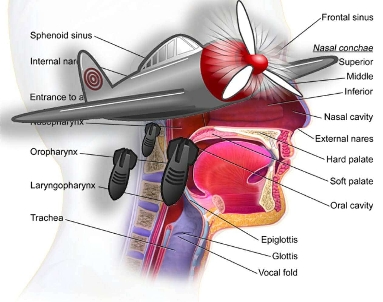 epiglottis AIR RAID mnemonic