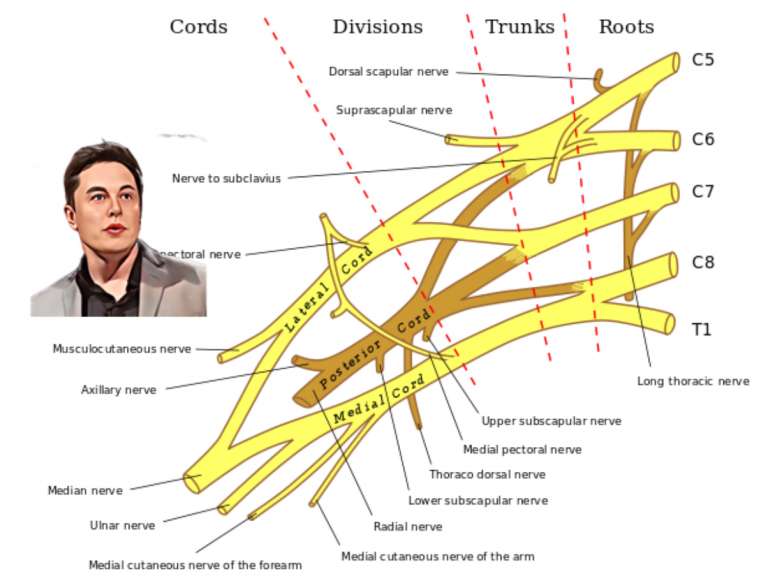 The Most Effective Brachial Plexus Mnemonic You'll Find
