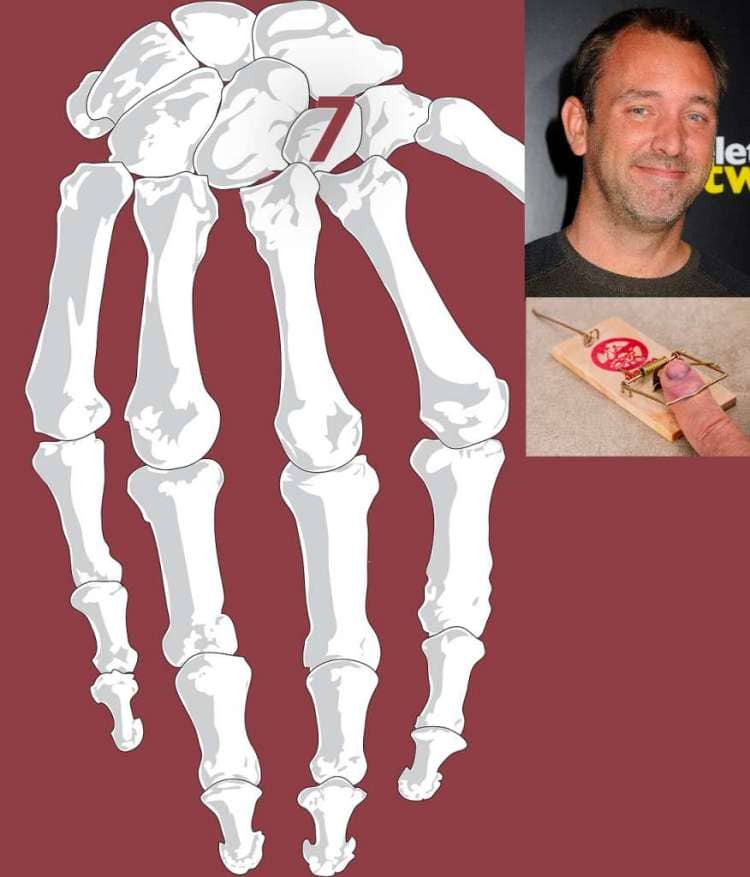 carpal bone mnemonic example for the trapezoid bone